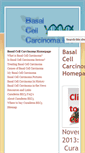 Mobile Screenshot of basalcellcarcinoma.info